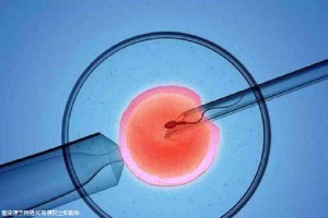 试管助孕生男孩